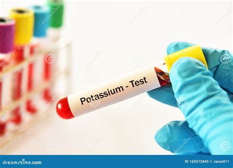 k-lab test|blood test for potassium called.